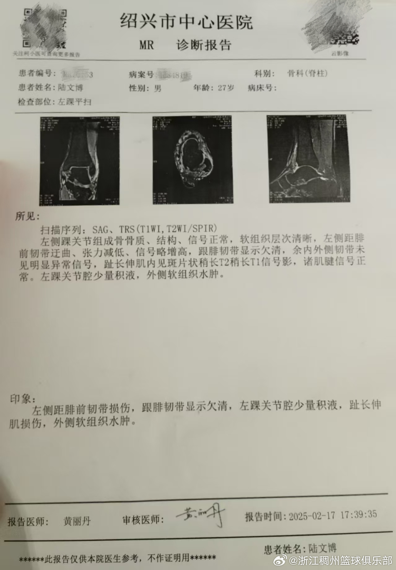 联赛背后的